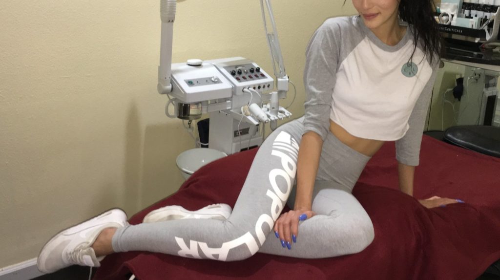 Why Winter is the Best Time for Laser Hair Removal? 2