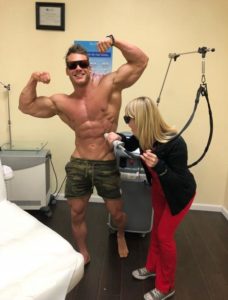 Laser Hair Removal for Bodybuilders 2