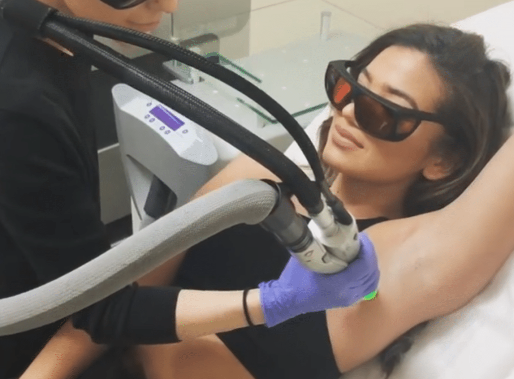 Laser Hair Removal Underarm