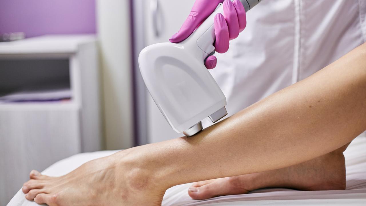 best laser hair removal las vegas