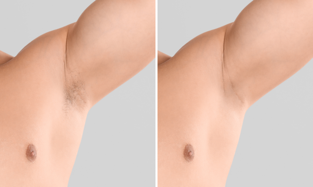 las vegas manscaping