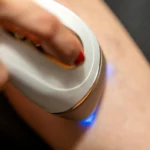 permanent hair removal las vegas guide