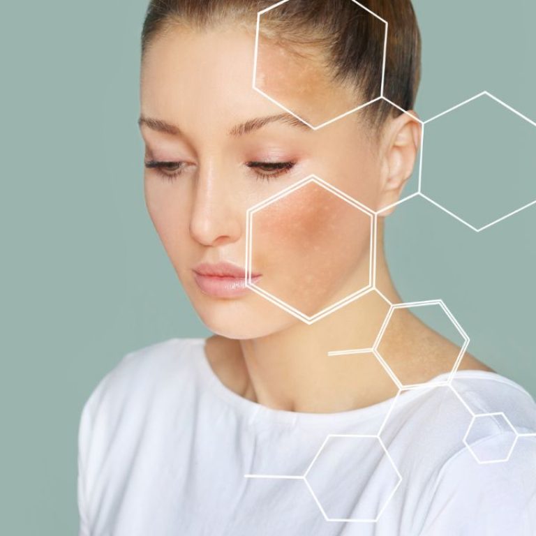 Laser Genesis skin treatment at Spoiled Aesthetics