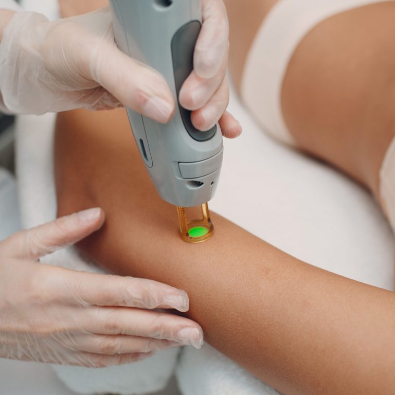 Laser,Epilation,And,Cosmetology.,Hair,Removal,Cosmetology,Procedure.,Laser,Epilation